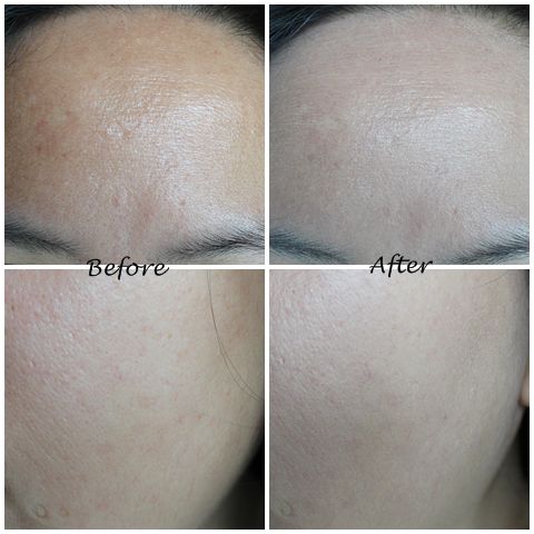 Shini Star BB Lotion with SPF 20